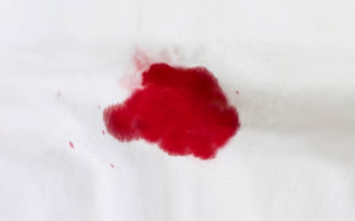 Kızlık Zarı Yırtılınca Ne Kadar Kanama Olur?